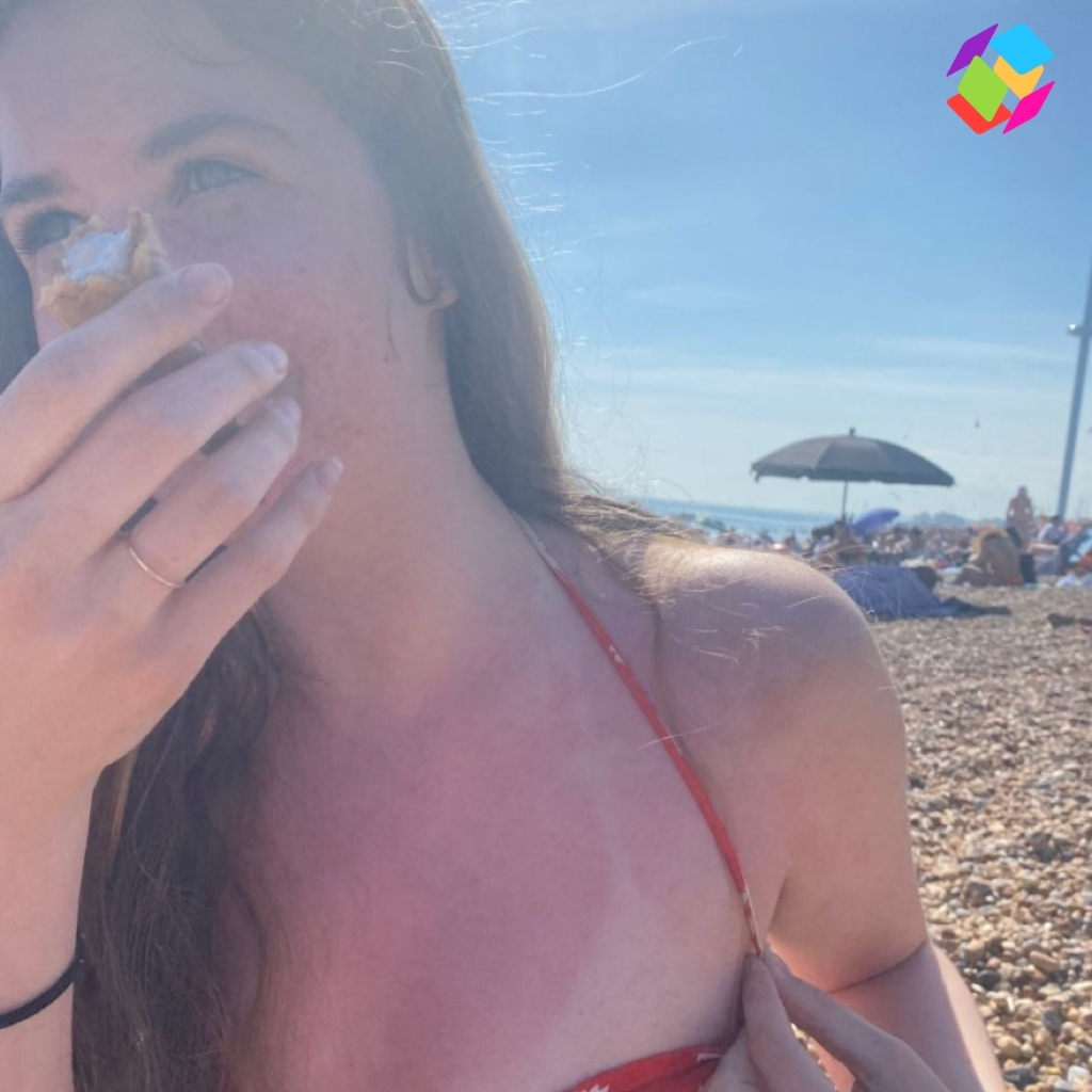 Sunburn Instagram Captions