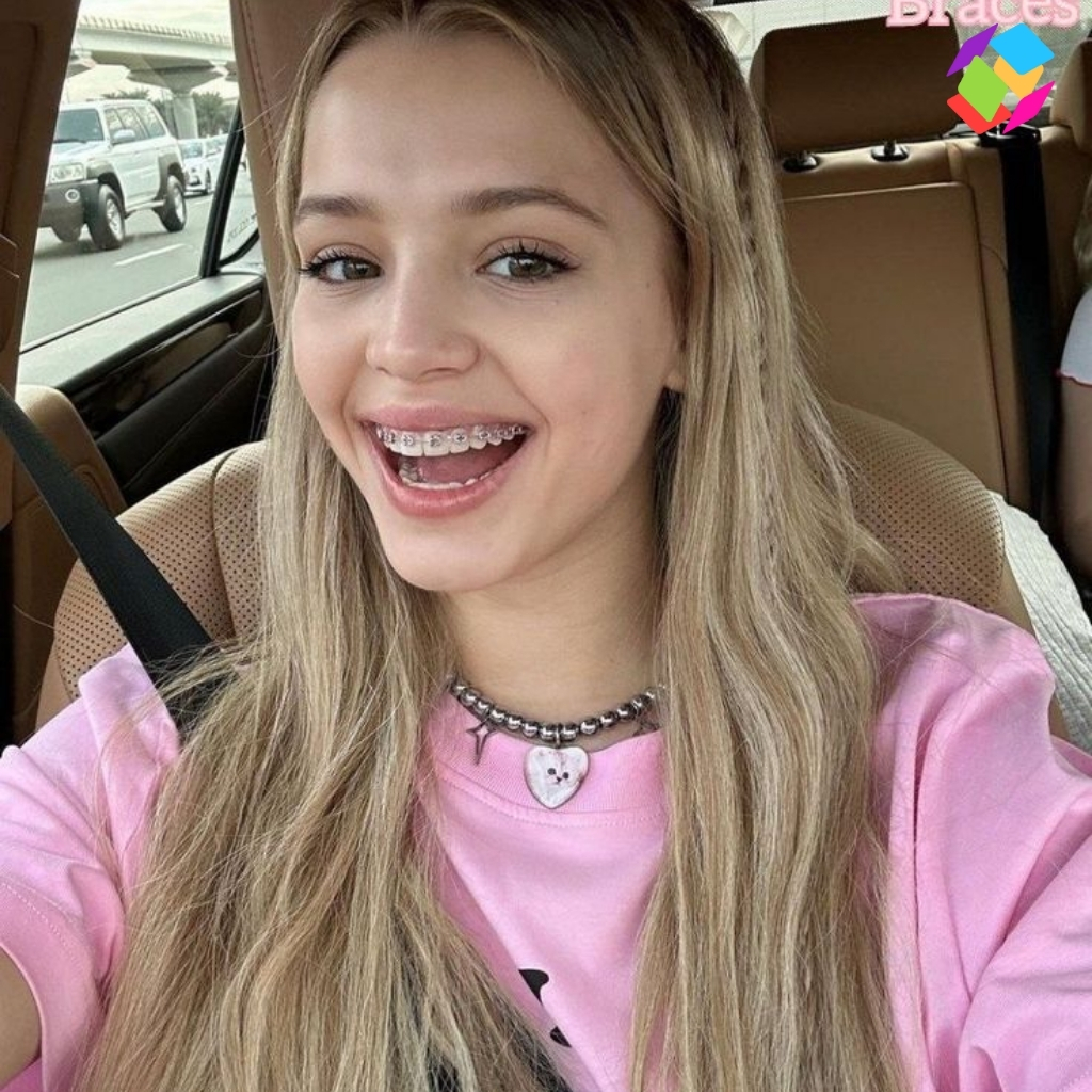 Instagram Captions For Braces